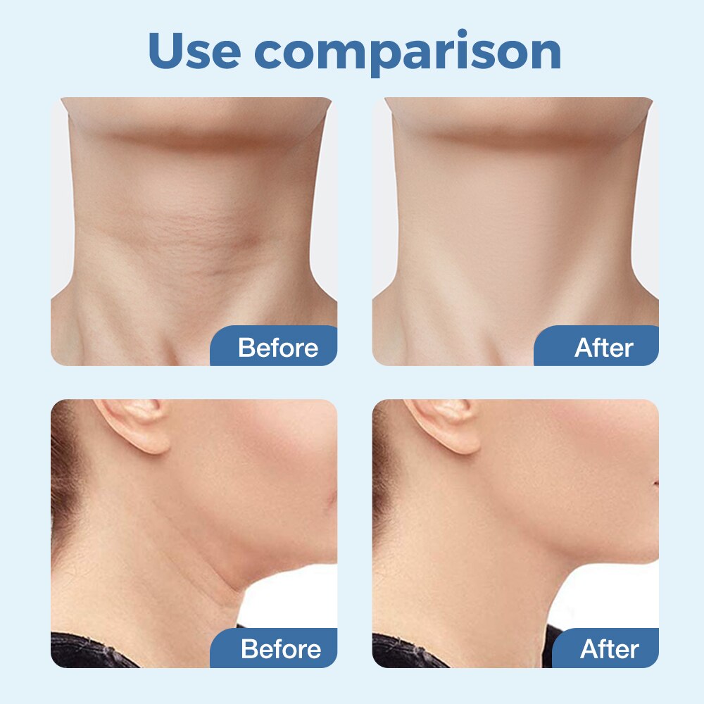 Anti-Aging Neck Beauty Device